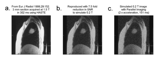 Lung Images