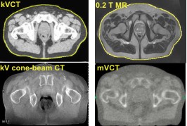 Typical Images of the Prostate