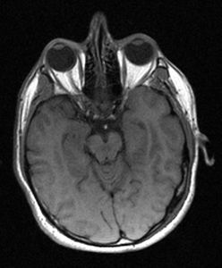 Image from Linac MRI Head Scan